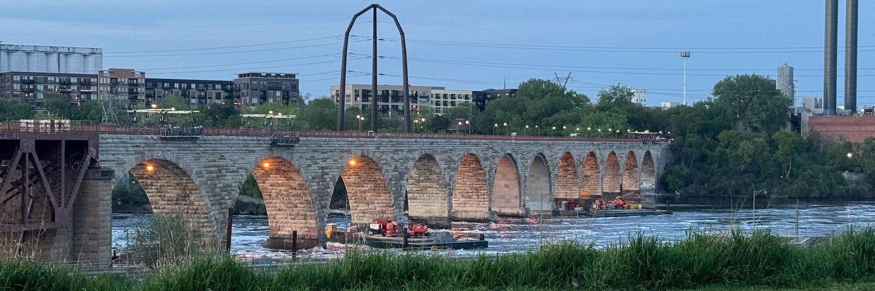 Composite Bonding | Dentist