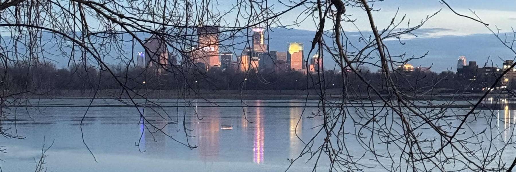 Crowns and Bridges | Dentist